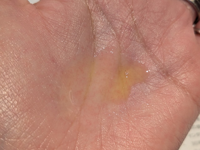 ママ&キッズ 薬用アクネスポッツ テクスチャ