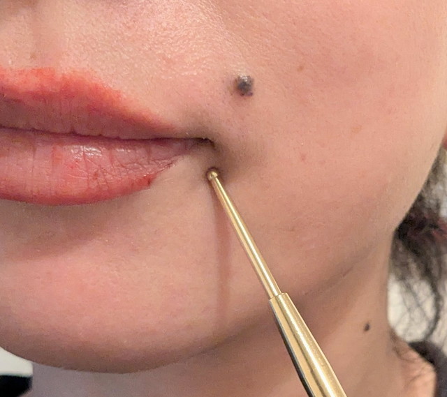 ミミミ ツボフェイスポインター 口元のツボを押しているシーン